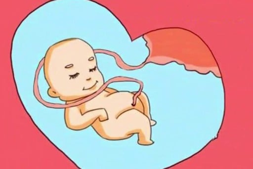 7 LÝ DO KHIẾN THAI NHI BỊ DÂY RỐN QUẤN CỔ! MẸ BẦU NÊN HẠN CHẾ NHÉ-24h68